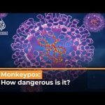 Monkeypox virus outbreak: What’s happening?